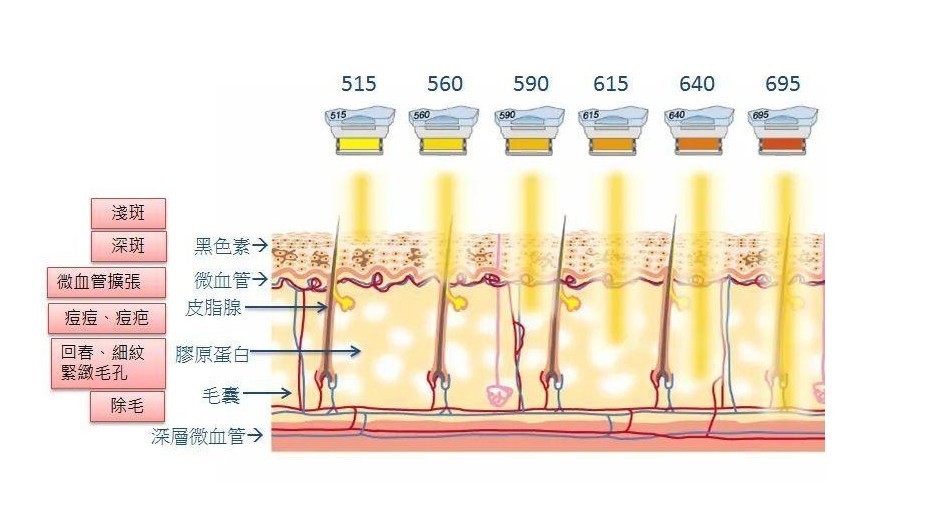 強(qiáng)脈沖濾光片光子美容波段滲透皮膚層